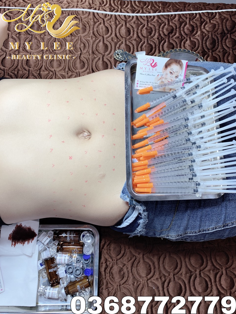 z4378907739771 f77ce6f98fd97e8dfae016178fc36a4a