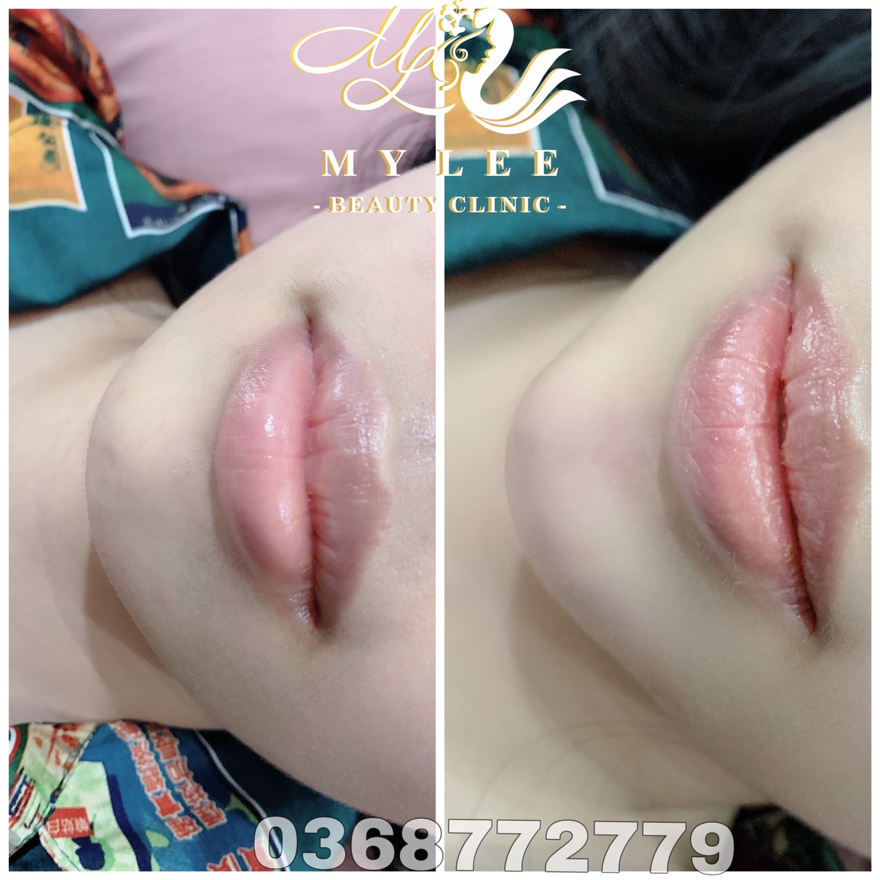 z4378907775481 c44245a2b027c57ed1f1e8209137c84c 1