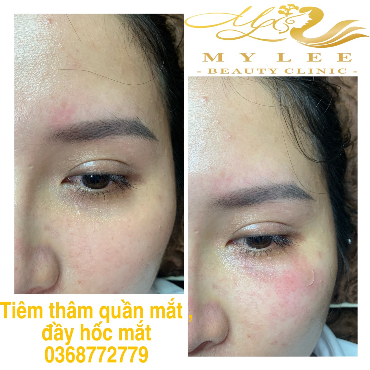 z4378907925966 afc564a06f0f53049c40ce15e941ba55