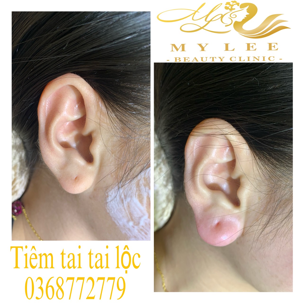 z4378907954490 74cb99e85a3bd493b721660618e816a5