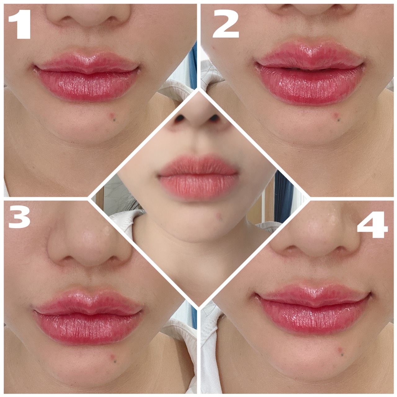 z4378915423603 dd9561307f42f810592fe3d82c09dc3f