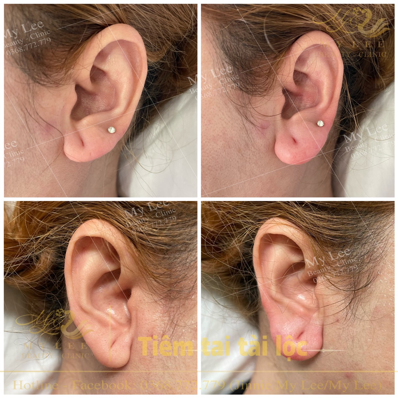 z4378915434856 dd1edf3edc5d5950726a461b4fb48566