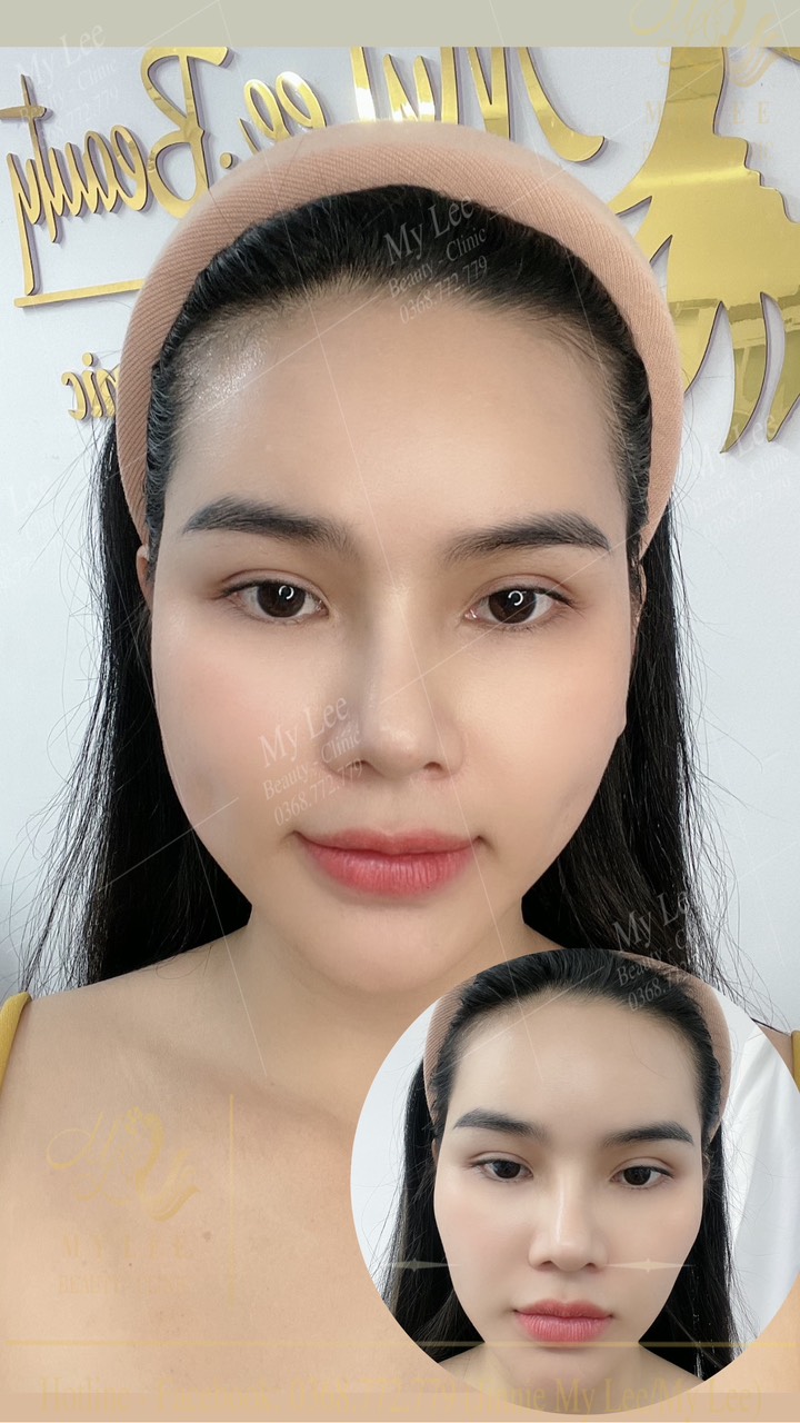 z4378915628346 3ca1a97a6291a599a6bca94aa77260ab