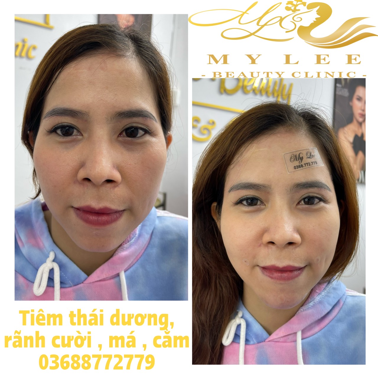 z4378933018096 3a532883713d541692d8fa213bc4d061