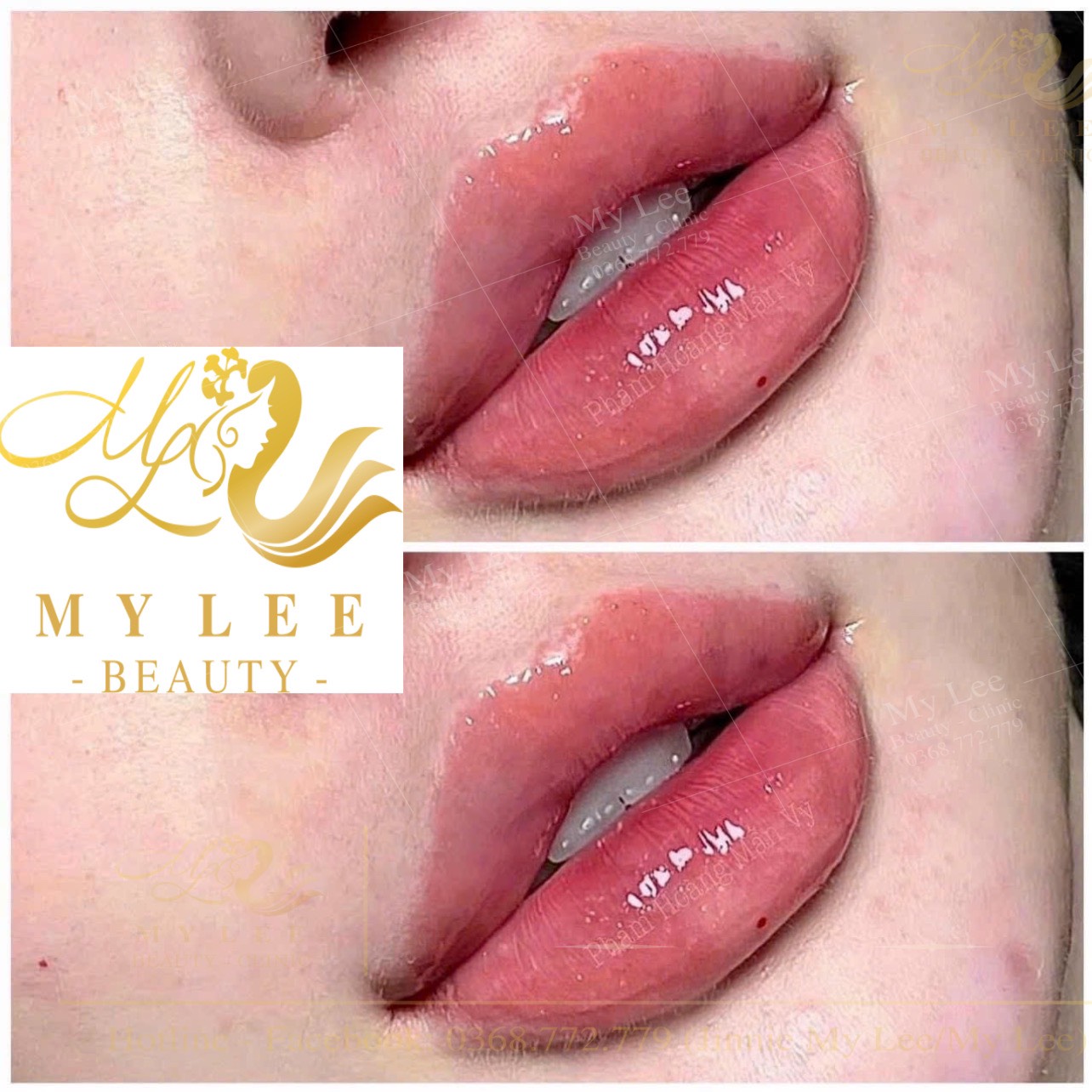 z4378933059118 26a6e4c1a6074daee43e45d371838fac