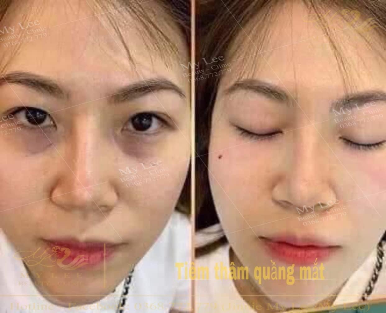 z4378933104875 ef8c30210d0265bde53f106d39b2547c