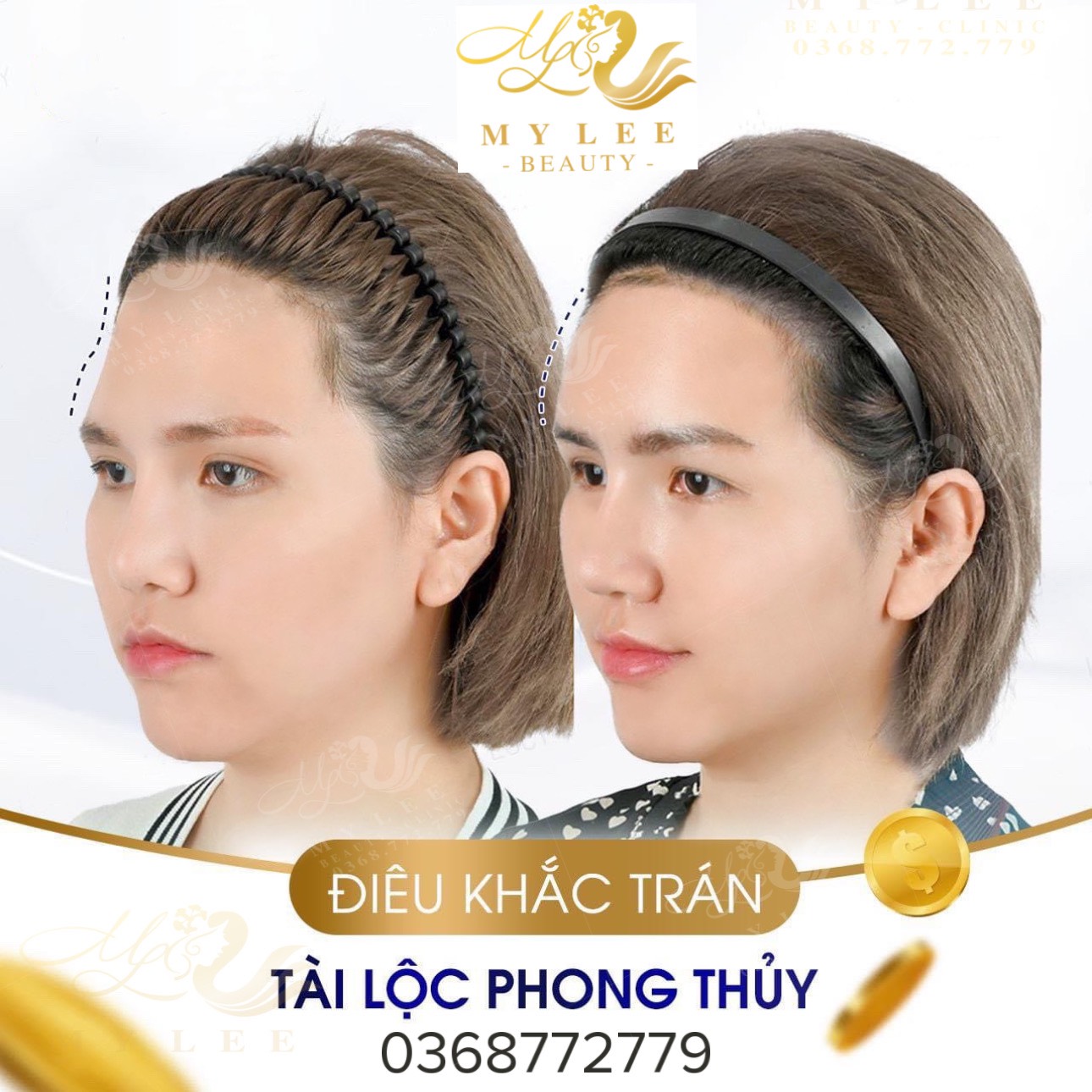 z4378933126285 4eec7501ec48341e7915f1db9e181251