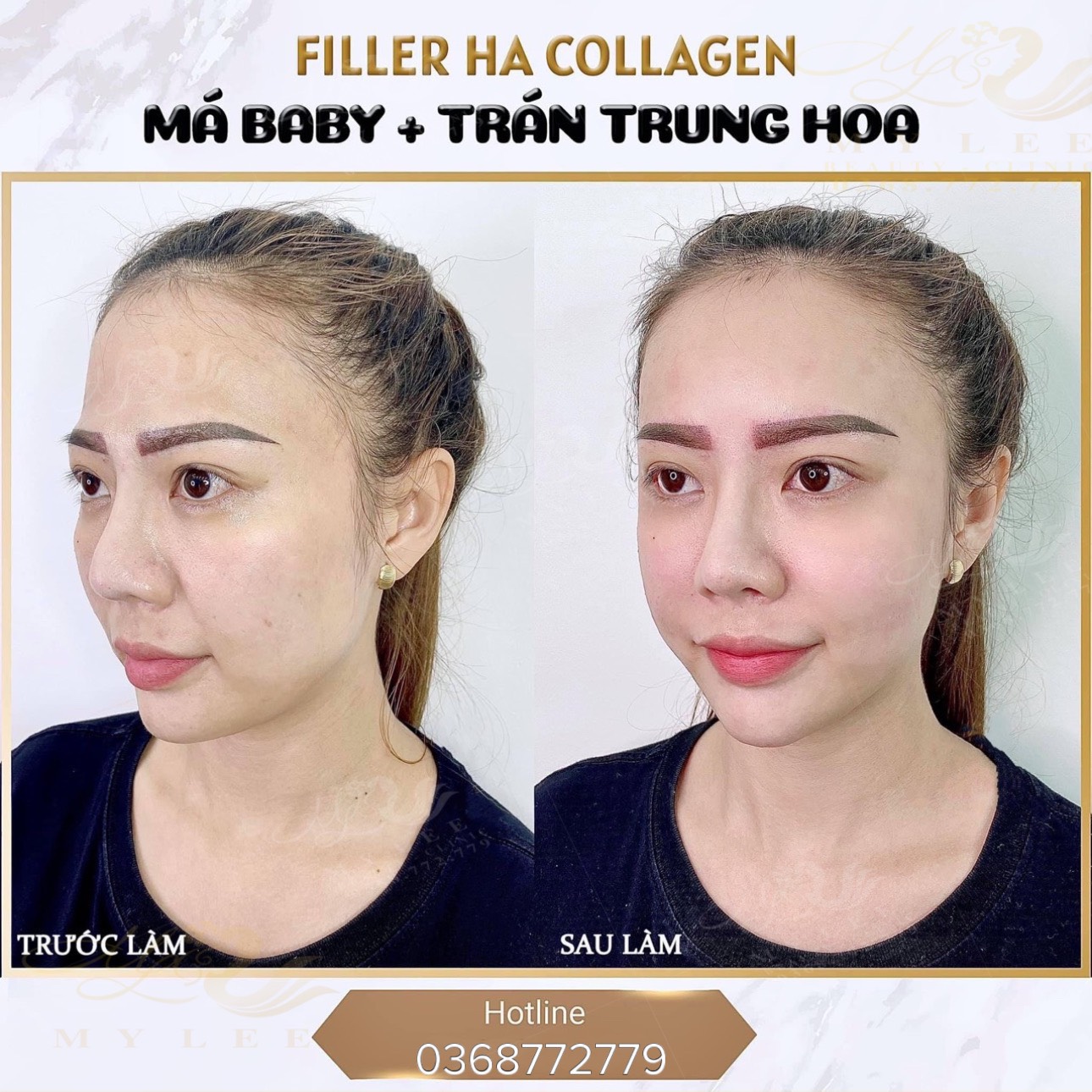 z4378933135854 dd63bdbf9cfc2701848d7711572bc96f