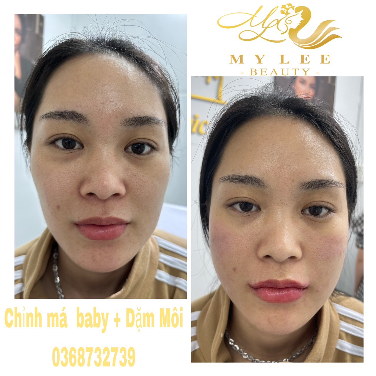 z4378933223030 a15fac5942d4e4d95dbba7ae75088ee5