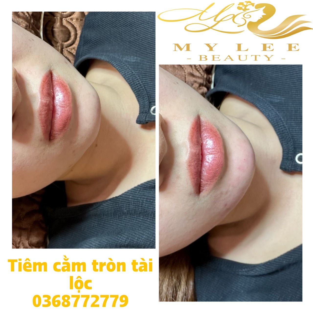 z4378933237157 64f634a8e5582ae0aa5ebc1e070f9635