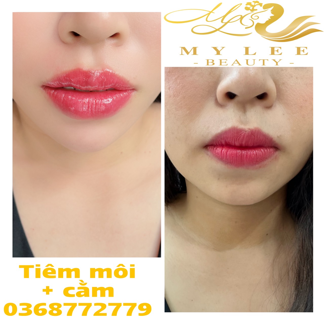 z4378933242106 7bcbf38974419ecdebbdbb49daf721c1