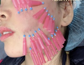 Căn chỉ collagen trẻ hoá