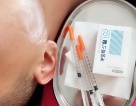 Tiêm thon gọn hàm vline