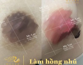 Làm hồng nhủ hóa