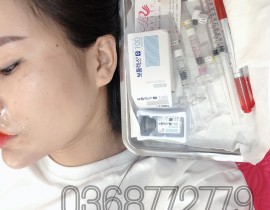 Tiem-botox-thon-gon-ham-vline-Nha-Trang-1.jpg